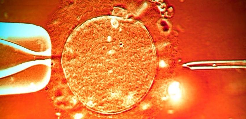 ICSI (Intracytoplasmic Sperm Injection)