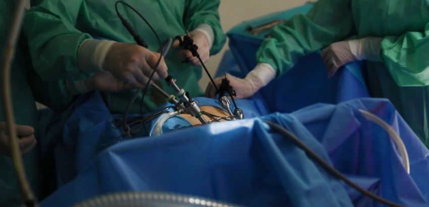 Laparoscopy