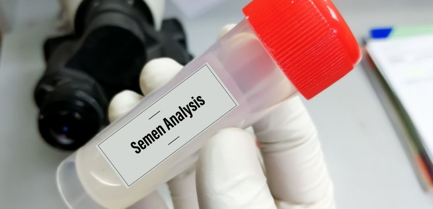 Semen Analysis